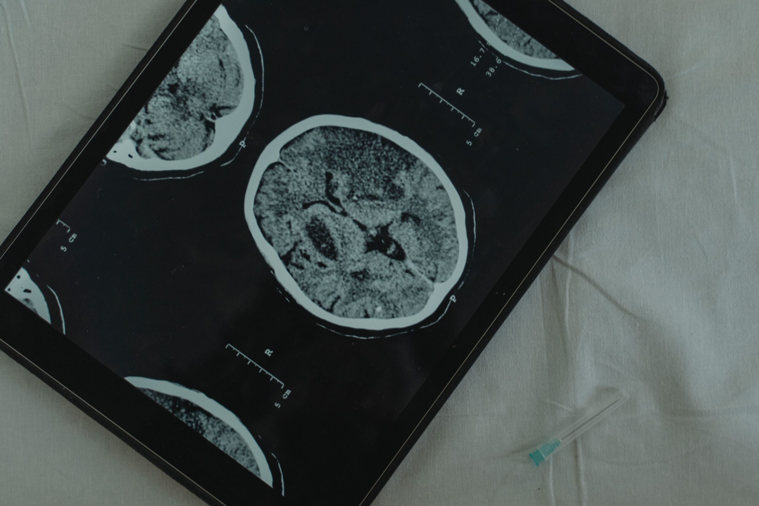 Image du cerveau affichée sur une tablette numérique