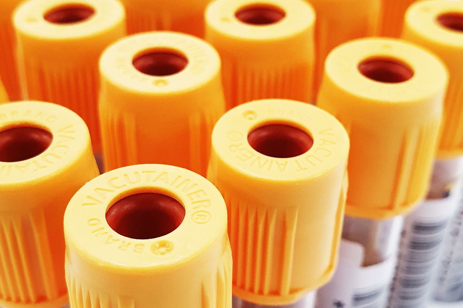 Résultats de laboratoire en ligne : accéder à ses analyses sans se déplacer